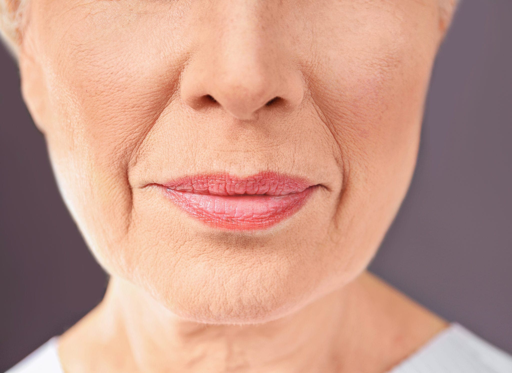 dermal fillers used to help Anti-wrinkle Fillers (Nasolabial Folds)